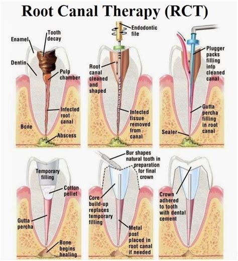 Dentistry Illustrated Tooth And Tips