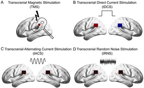 Noninvasive Brain Stimulation Multiple Effects On Cognition Gesa Hartwigsen Juha Silvanto 2023