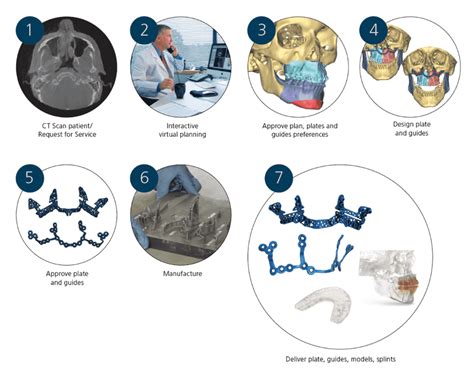 3d Printing Medical Devices Depuy Synthes