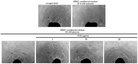 Aortic Ring Assay Showing The Diminution Of Diabetic Angiogenesis By