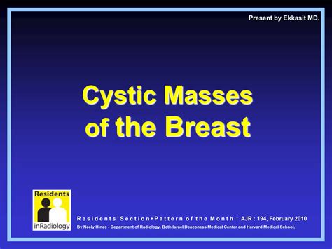 Cystic Masses Of The Breast A Concise Guide Ppt