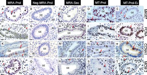 Figure 2 From Assessment Of The Proliferative Status Of Epithelial Cell