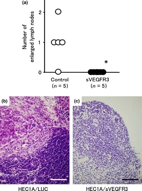 Suppression Of Lymph Node And Lung Metastases Of Endometrial Cancer By