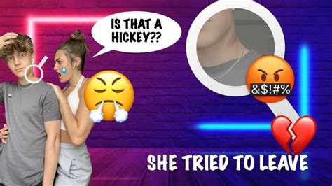 Hickey Prank On Girlfriend She Tries To Breakup With Me Youtube