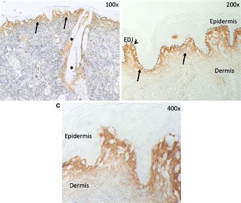 Typical Periostin Expression In Human Normal Skin Representative