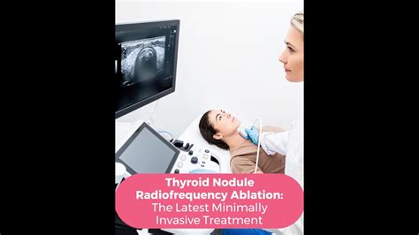 Thyroid Nodule Radiofrequency Ablation Rfa The Latest Minimally