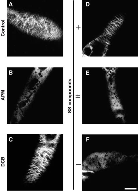 Cortical Microtubule Orientation In Chemically Treated Cells Cells