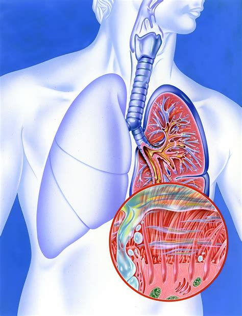 Lower Respiratory Tract Infection Photograph by John Bavosi - Pixels