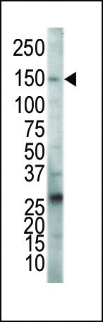 VEGFR2 FLK1 KDR Antibody C Term Purified Rabbit Polyclonal