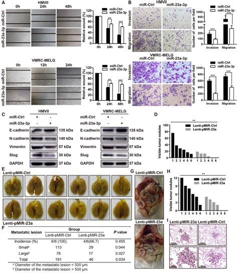 Overexpression Of Mir 23a 3p Inhibits Mucosal Melanoma Metastasis In