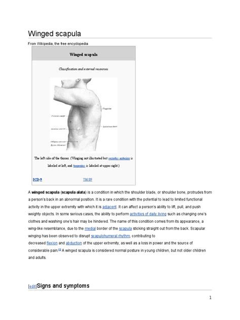 Winged Scapula | Neurology | Neurological Disorders