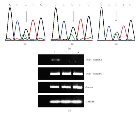 A Nucleotide Sequence Chromatograms Across The Comt G675a Haplotype Download Scientific