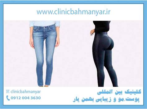 چگونه شکم تخت باسن خوش فرم و بزرگ و کمر باریک داشته باشیم کلینیک