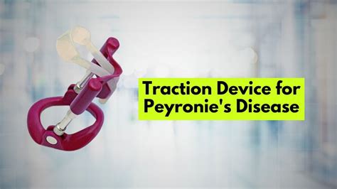 The Most Effective Traction Device For Peyronies Disease Treatment