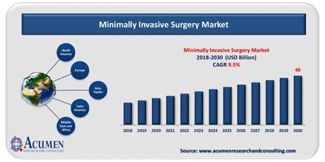 Minimally Invasive Surgery Market Size Share Statistics