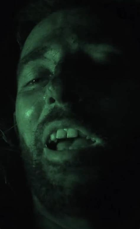 Naked And Afraid Star Gets Medical Help After Burning Penis In Full Frontal Clip Daily Star