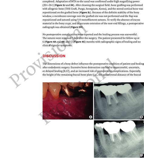 A The 6 Months Follow Up Clinical Image B The 6 Months Follow Up