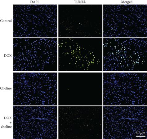 Effect Of Choline Treatment On Apoptosis In Cardiac Tissue A Tunel