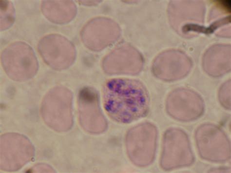 Plasmodium Ovale Morphology