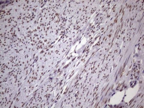 Nudt Monoclonal Antibody Oti B Truemab Origene L