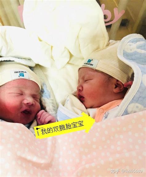 重庆宽窄优孕结婚3年备孕失败，三代试管1次成功生下双胞 知乎