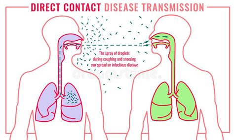 Infectious Disease Transmission Stock Vector - Illustration of ...