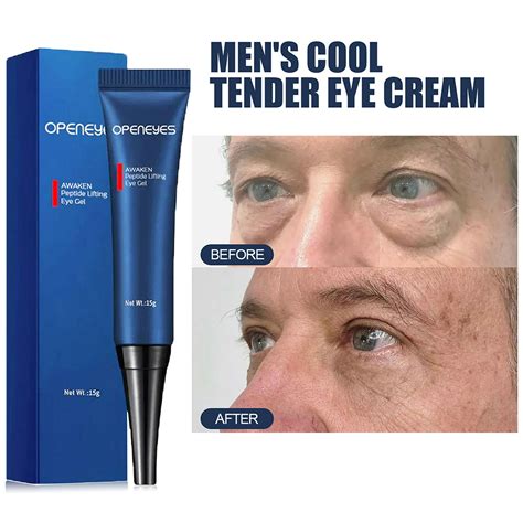 Los hombres eliminan las bolsas de los ojos del círculo oscuro Crema