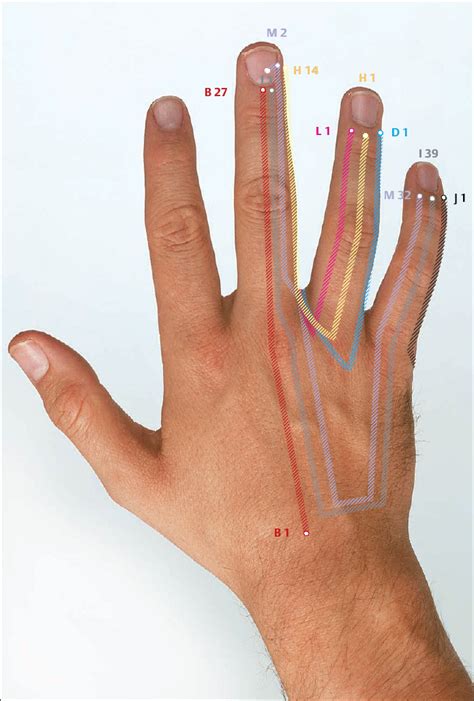 Korean Hand Acupuncture Musculoskeletal Key