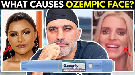 Debunking Ozempic Face Myths Facial Plastic Surgeon Weights In Is