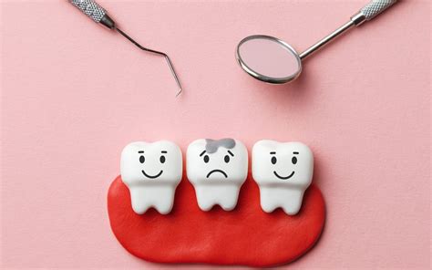 Caries En Niños Clínica Dental Oliva Dentoliva