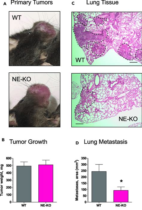 NE Is Critical For Spontaneous Metastasis In A Syngeneic Mouse Model Of