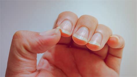 What Causes Your Nails To Split And How Can You Prevent It