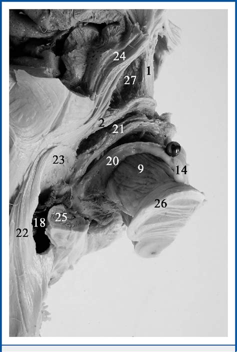 Figure 1 from Microsurgical Anatomy of the Anterior Commissure ...