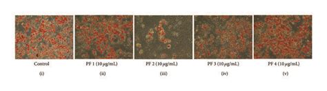 Effect Of Pfs On Adipogenesis In 3t3 L1 Adipocytes A Intracellular