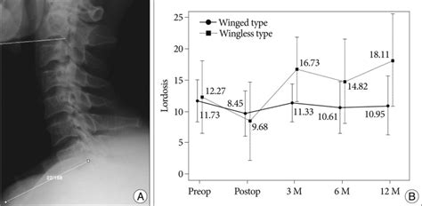 A Cervical Lordosis Defined As The Angle Between C2 And C7 Inferior Download Scientific