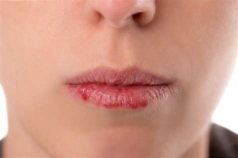 Consejos Para Aliviar La Resequedad De Los Labios Y Que Luzcan Saludables