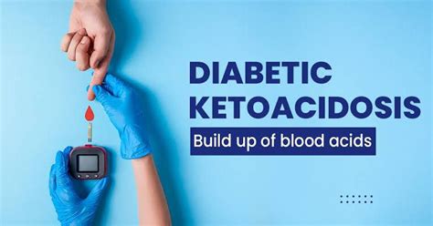 Risk Of Diabetic Ketoacidosis MEDizzy