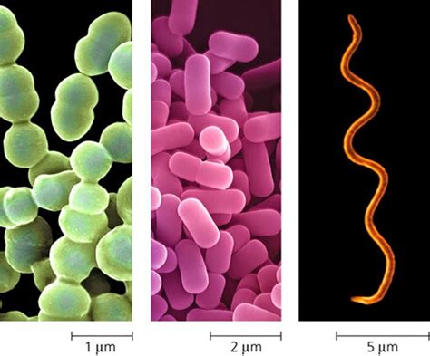 Odd Organisms: Three Prokaryotes