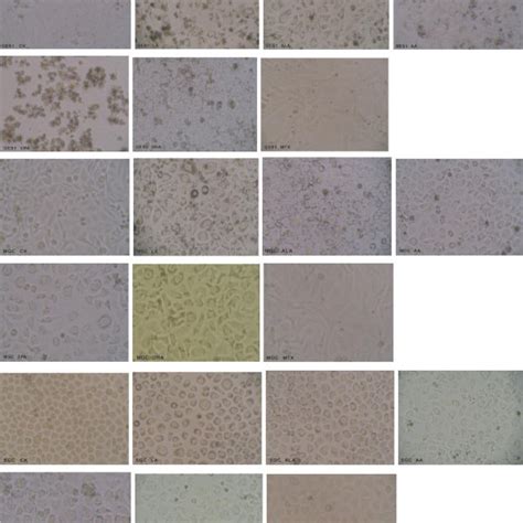 Morphological Changes In GES1 MGC And SGC Cells Treated With Various