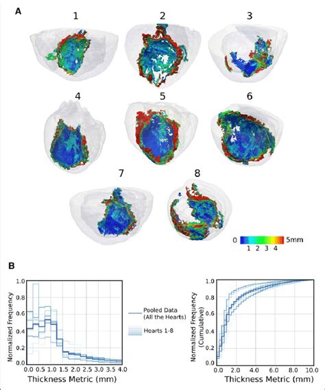 Visualization and characterization of surviving tissue surrounding the ...