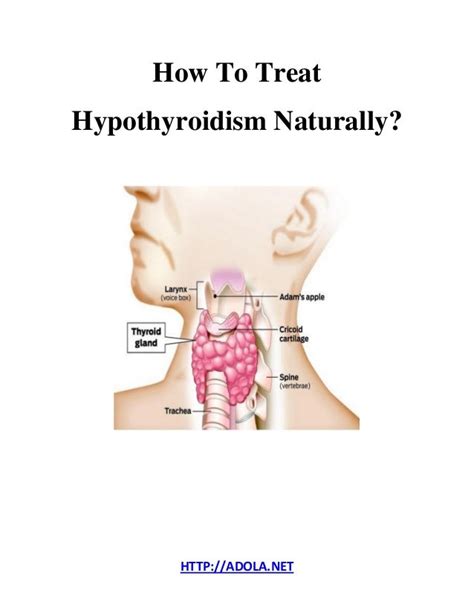 How To Treat Hypothyroidism Naturally