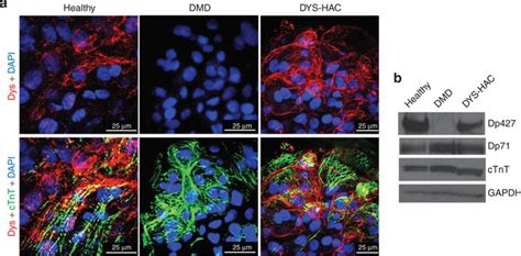 Hac Mediated Restoration Of Dystrophin Protein Expression And Correct