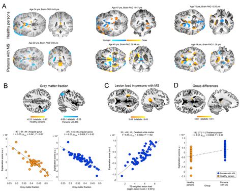 Regional Brain Aging A Illustrates The Brain Age Prediction Approach