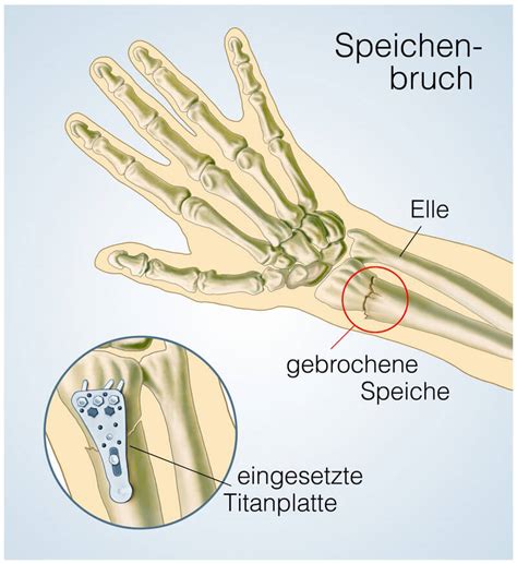 Das Handgelenk Wichtig F R Bestimmte Bewegungen Der Hand Finger