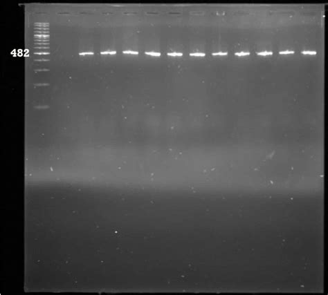 Gel Electrophoresis For The Detection Of Enteropathogenic E Coli Download Scientific Diagram