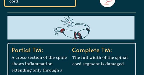 Transverse Myelitis And Ms Multiple Sclerosis News Today