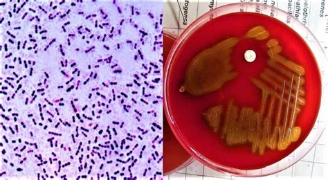 Streptococcus Pneumoniae Morphology