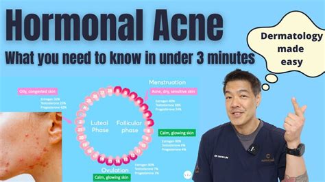 Hormonal Acne Explained In Under 3 Minutes Dermatologist Reviews