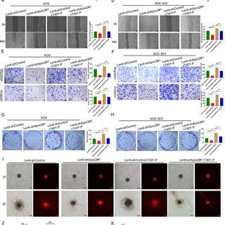 Inhibition Of Apoc Suppresses Cell Migration Invasion Proliferation