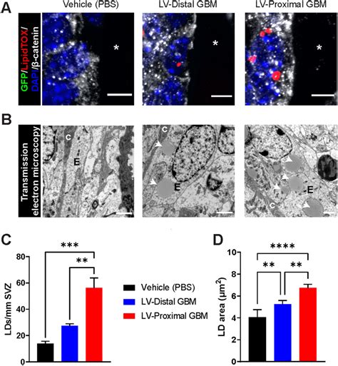 Lipid Droplets Accumulate In Ependymal Cells Dependent On Tumor Download Scientific Diagram